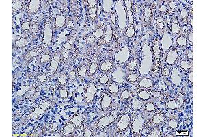Formalin-fixed and paraffin embedded rat kidney labeled with Anti-AQP5 Polyclonal Antibody, Unconjugated (ABIN731258) followed by conjugation to the secondary antibody and DAB staining (Aquaporin 5 抗体  (AA 201-265))