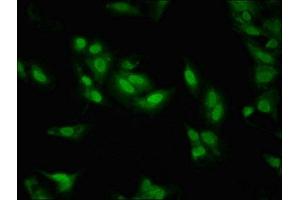 Immunofluorescent analysis of Hela cells using ABIN7158369 at dilution of 1:100 and Alexa Fluor 488-congugated AffiniPure Goat Anti-Rabbit IgG(H+L) (LIM Domain Binding 1 Protein 抗体  (AA 50-375))