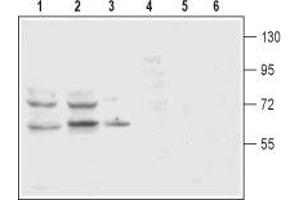 Western Blotting (WB) image for anti-Solute Carrier Family 6 (Neurotransmitter Transporter, Dopamine), Member 3 (SLC6A3) (AA 191-205), (Extracellular) antibody (ABIN7043740)