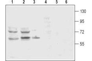 Western blot analysis of rat (lanes 1 and 4) and mouse (lanes 2 and 5) brain membranes and rat pheochromocytoma PC12 (lanes 3 and 6) cell lysates: - 1-3. (SLC6A3 抗体  (2nd Extracellular Loop))
