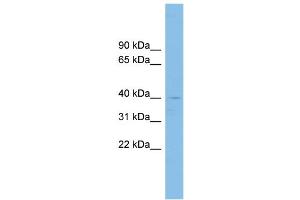 WB Suggested Anti-RFFL Antibody Titration: 0. (RFFL 抗体  (Middle Region))
