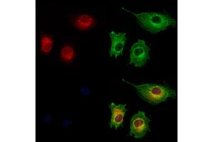 ABIN6261174 and ABIN6273223 staining HUVEC cells by IF/ICC. (PPIC 抗体  (Internal Region))