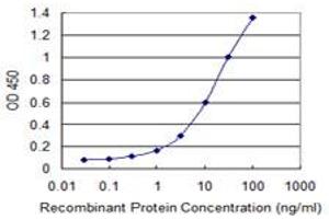 Detection limit for recombinant GST tagged BMP5 is 0. (BMP5 抗体  (AA 323-422))