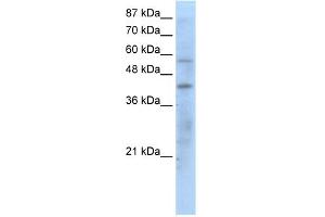 WB Suggested Anti-PPARG Antibody Titration:  1. (PPARG 抗体  (N-Term))