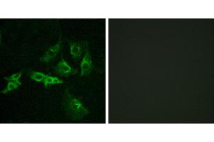 Peptide - +Immunofluorescence analysis of A549 cells, using GNRHR antibody. (GNRHR 抗体  (Internal Region))