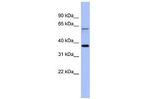 MAGEB1 antibody used at 1 ug/ml to detect target protein. (MAGEB1 抗体  (Middle Region))