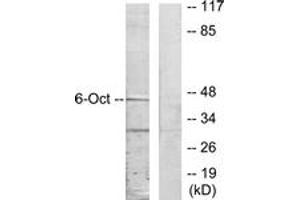 Western blot analysis of extracts from A549 cells, using OCT6 Antibody. (POU3F1 抗体  (AA 311-360))