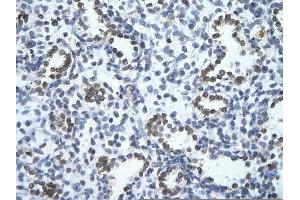 Rabbit Anti-PHF17 Antibody       Paraffin Embedded Tissue:  Human alveolar cell   Cellular Data:  Epithelial cells of renal tubule  Antibody Concentration:   4. (PHF17 抗体  (C-Term))