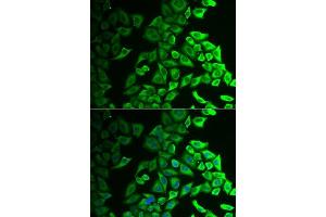 Immunofluorescence analysis of A549 cells using IL18BP antibody. (IL18BP 抗体  (AA 31-194))