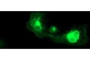 Anti-FGFR2 mouse monoclonal antibody (ABIN2454751) immunofluorescent staining of COS7 cells transiently transfected by pCMV6-ENTRY FGFR2 (RC217098). (FGFR2 抗体)