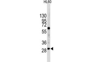 Western Blotting (WB) image for anti-Lin-28 Homolog B (LIN28B) antibody (ABIN2998297) (LIN28B 抗体)