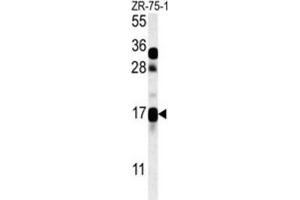 Western Blotting (WB) image for anti-CSAG Family, Member 2 (CSAG2) antibody (ABIN3002341) (CSAG2 抗体)