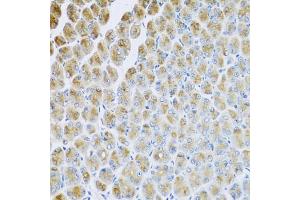 Immunohistochemistry of paraffin-embedded mouse stomach using AP1M2 antibody (ABIN5974667) at dilution of 1/100 (40x lens). (AP1m2 抗体)