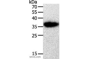 Western blot analysis of A549 cell, using PLAUR Polyclonal Antibody at dilution of 1:450 (PLAUR 抗体)
