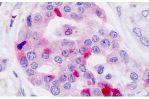 Anti-GLP-1 Receptor / GLP1R antibody IHC staining of human pancreas, islet of langerhans. (GLP1R 抗体  (N-Term))