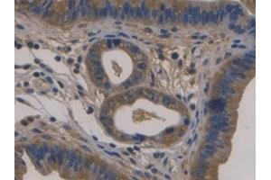 Detection of FBLN1 in Mouse Uterus Tissue using Monoclonal Antibody to Fibulin 1 (FBLN1) (Fibulin 1 抗体  (AA 399-578))