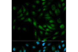 Immunofluorescence analysis of MCF-7 cells using MAPK7 Polyclonal Antibody (MAPK7 抗体)