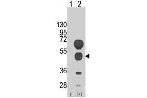 Western blot analysis of GATA4 (arrow) using rabbit GATA4 polyclonal antibody . (GATA4 抗体  (C-Term))