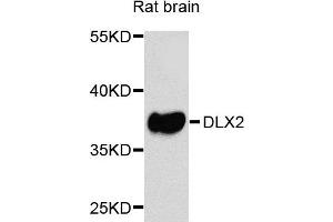 Western blot analysis of extracts of rat brain cells, using DLX2 antibody.