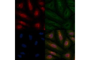 ABIN6259171 and ABIN6275708 staining  cells by IF/ICC. (RAD51C 抗体  (Internal Region))