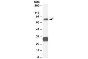 Western blot testing of human cerebellum lysate with FOXP2 antibody at 0. (FOXP2 抗体)