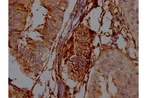 Immunohistochemistry (IHC) image for anti-5'-Nucleotidase, Ecto (CD73) (NT5E) antibody (ABIN7127408)