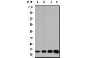 Western blot analysis of CIDEB expression in HT29 (A), RAW264. (CIDEB 抗体)