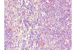 Immunohistochemistry of paraffin-embedded human lymph node tissue using ABIN7158541 at dilution of 1:100 (FCGR2B 抗体  (AA 12-289))