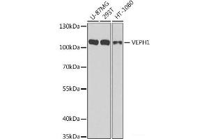Western blot analysis of extracts of various cell lines using VEPH1 Polyclonal Antibody at dilution of 1:1000. (VEPH1 抗体)