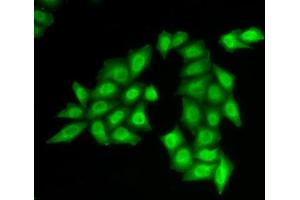 Immunofluorescence analysis of HeLa cells using SSRP1 antibody (ABIN6129536, ABIN6148492, ABIN6148494 and ABIN6217711). (SSRP1 抗体  (AA 1-300))