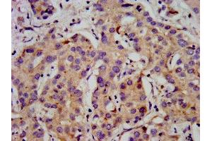 Immunohistochemistry (IHC) image for anti-Calcium Channel, Voltage-Dependent, beta 2 Subunit (CACNB2) (AA 490-637) antibody (ABIN7175596)