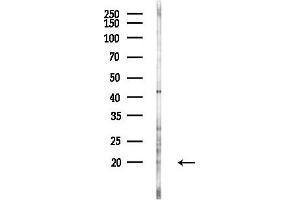 Western blot analysis of lysates from HUVEC cells(LPS 4h treatment), using IL7 Antibody at 1/1000 dilution.