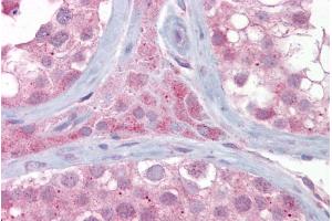 Immunohistochemistry with Testis tissue at an antibody concentration of 5µg/ml using anti-UBE2L3 antibody (ARP43023_P050) (UBE2L3 抗体  (Middle Region))