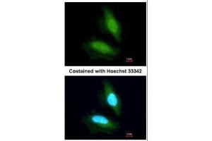 ICC/IF Image Immunofluorescence analysis of paraformaldehyde-fixed HeLa, using NPEPPS, antibody at 1:200 dilution. (NPEPPS 抗体)