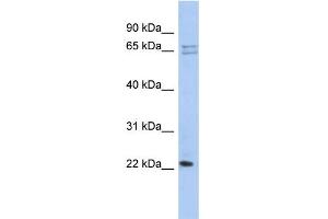 WB Suggested Anti-RPL18 Antibody Titration: 0. (RPL18 抗体  (N-Term))