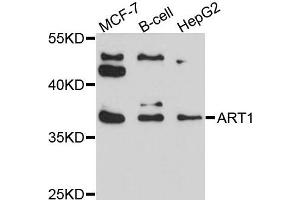 Western blot analysis of extracts of various cells, using ART1 antibody. (ART1 抗体)
