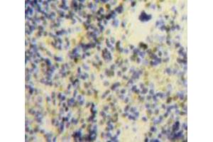 Used in DAB staining on fromalin fixed paraffin-embedded Spleen tissue (CXCL9 抗体  (AA 22-126))