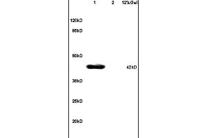 L1 mouse brain lysates L2 human colon carcinoma lysates probed with Anti - phospho-JNK1/2/3 (Thr183+Thr185) Polyclonal Antibody, Unconjugated at 1:200 in 4 ˚C. (JNK 抗体  (pThr183, pTyr185))