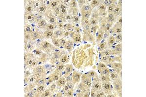Immunohistochemistry of paraffin-embedded rat liver using RAD9A antibody at dilution of 1:200 (400x lens).