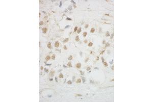 Immunohistochemistry (IHC) image for anti-UTP6, Small Subunit (SSU) Processome Component, Homolog (UTP6) (AA 565-597) antibody (ABIN7448592)