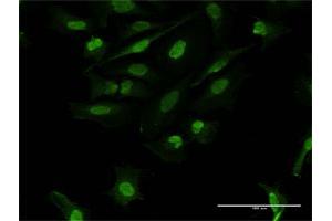 Immunofluorescence of purified MaxPab antibody to FOSL2 on HeLa cell.