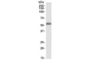 Western blot testing of human heart lysate with ADRB1 antibody at 0. (ADRB1 抗体)