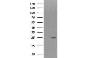 Image no. 1 for anti-Fibronectin Type III Domain Containing 4 (FNDC4) antibody (ABIN1498288) (FNDC4 抗体)