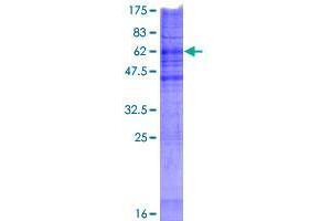 CHPT1 Protein (AA 1-406) (GST tag)