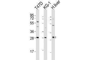 Western Blot at 1:2000 dilution Lane 1: T47D whole cell lysates Lane 2: KG-1 whole cell lysates Lane 3: human liver lysates Lysates/proteins at 20 ug per lane. (TIM3 抗体  (AA 167-194))