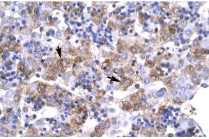 Rabbit Anti-POU1F1 Antibody Catalog Number: ARP31419 Paraffin Embedded Tissue: Human Liver Cellular Data: Hepatocyte Antibody Concentration: 4. (POU1F1 抗体  (C-Term))
