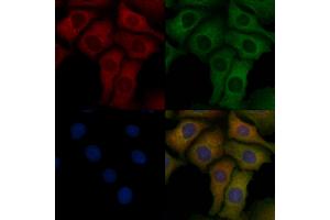 ABIN6258288 and ABIN6275675 staining Hela cells by IF/ICC. (NSF 抗体  (Internal Region))
