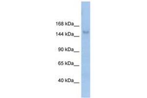 Image no. 1 for anti-Mov10l1, Moloney Leukemia Virus 10-Like 1 (MOV10L1) (AA 71-120) antibody (ABIN6742690) (MOV10L1 抗体  (AA 71-120))