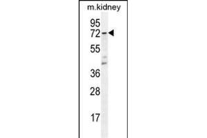 CYP5A1 Antibody (Center) (ABIN656016 and ABIN2845391) western blot analysis in mouse kidney tissue lysates (35 μg/lane). (TBXAS1 抗体  (AA 226-257))