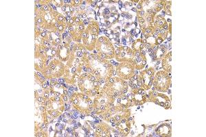 Immunohistochemistry of paraffin-embedded rat kidney using LAP3 antibody (ABIN5975480) at dilution of 1/100 (40x lens). (LAP3 抗体)